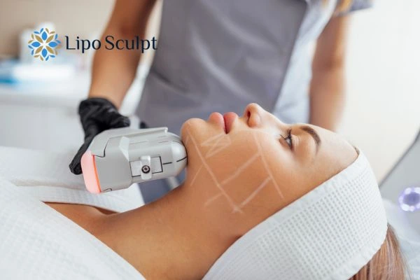 HIFU vs Botulinum Toxin: Understanding the Differences 1 HIFU vs Botox Wincanton What is the best option for you?