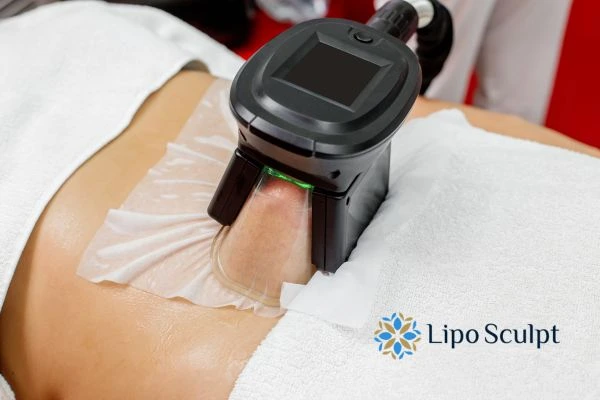 Does Fat Freezing at Home Work? DIY Devices vs Professional Cryolipolysis 1 How is professional cryolipolysis different Wincanton?